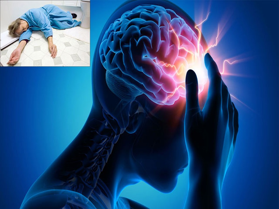 Phân biệt giai đoạn cấp và giai đoạn mạn của tai biến mạch máu não
